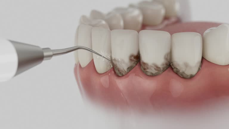 Trusted Teeth Cleaning And Checkup service in Bridgeton, MO - Dentist Open Now